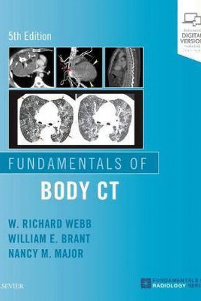 Portada del libro Fundamentals Of Body Ct