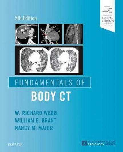 Portada del libro Fundamentals Of Body Ct