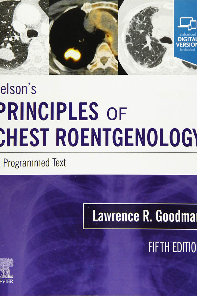 Portada del libro Felson´s Principles Of Chest Roentgenology A Programmed