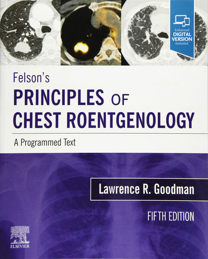 Portada del libro Felson´s Principles Of Chest Roentgenology A Programmed