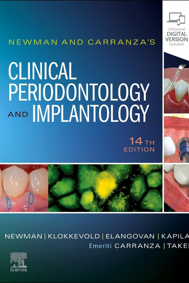 Newman And Carranza's Clinical Periodontology Implantology