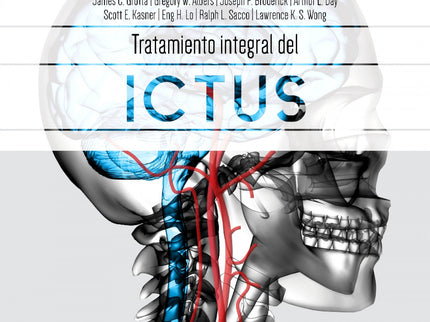 Tratamiento Integral Del Ictus
