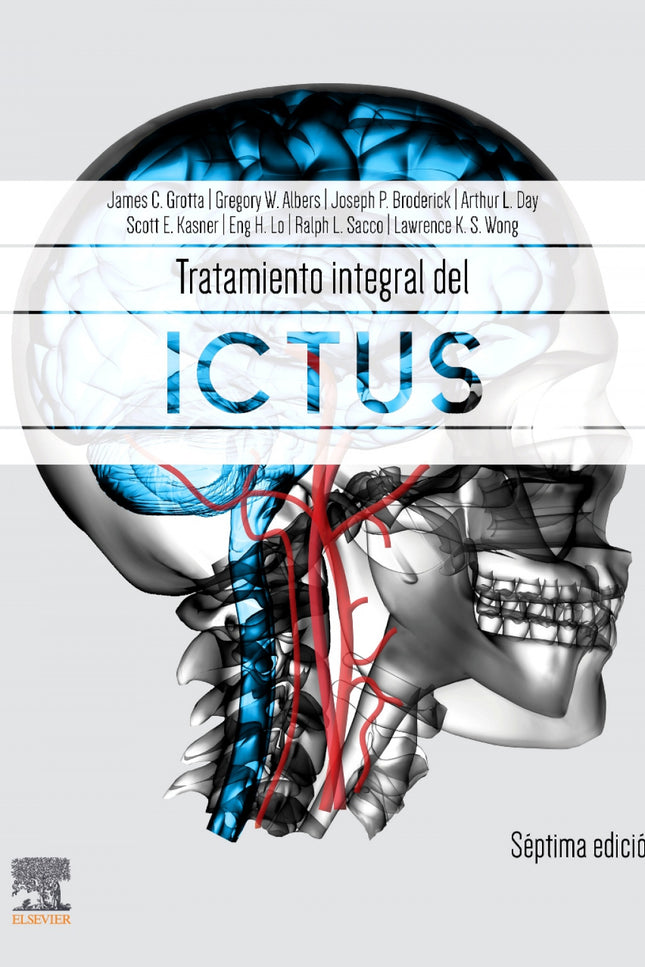 Tratamiento Integral Del Ictus