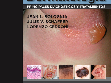 Dermatología: Principales Diagnósticos Y Tratamientos (2ª Ed.)
