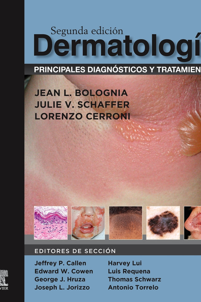 Dermatología: Principales Diagnósticos Y Tratamientos (2ª Ed.)