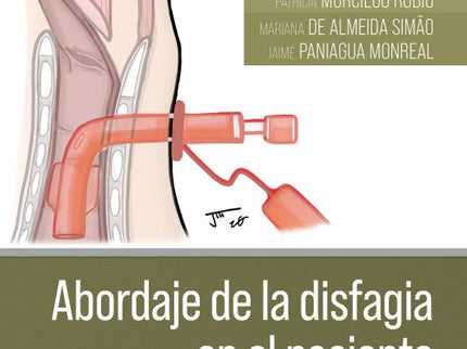 Abordaje De La Disfagia En El Paciente Traqueostomizado