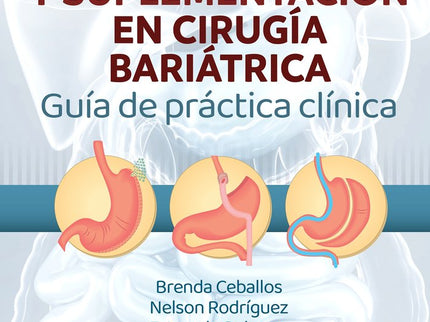 MANEJO NUTRICIONAL Y SUPLEMENTACION EN CIRUGIA BARIATRICA - Brenda Ceballos González - Tapa blanda