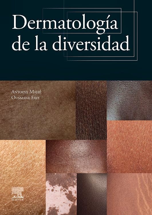 Dermatologia De La Diversidad
