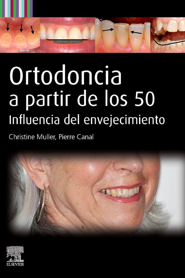 Ortodoncia A Partir De Los 50