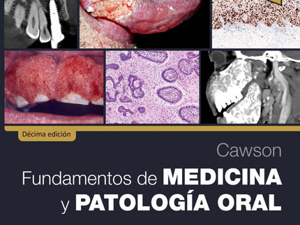 Cawson.fundamentos De Medicina Y Patologia Oral