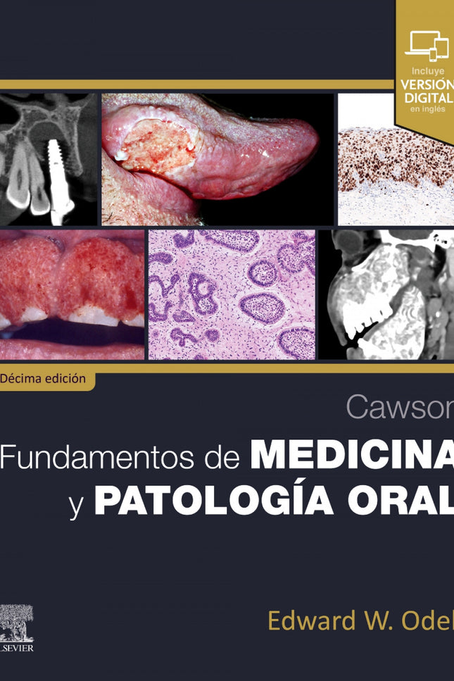 Cawson.fundamentos De Medicina Y Patologia Oral