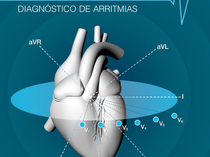 Electrocardiografía De Perros Y Gatos
