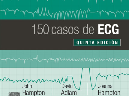 Libro 150 Casos De Ecg: 150 casos de ECG es la quinta edición de 150 problemas de ECG;en esta edición se ha modificado el título para destacar la importancia de relacionar el ECG con el paciente al que se le ha realizado dicha prueba, procediendo todos los registros de pacientes reales. Este manual sigue manteniendo el objetivo de las ediciones previas: mejorar los conocimientos del lector acerca del ECG poniendo a prueba sus habilidades de reconocimiento.