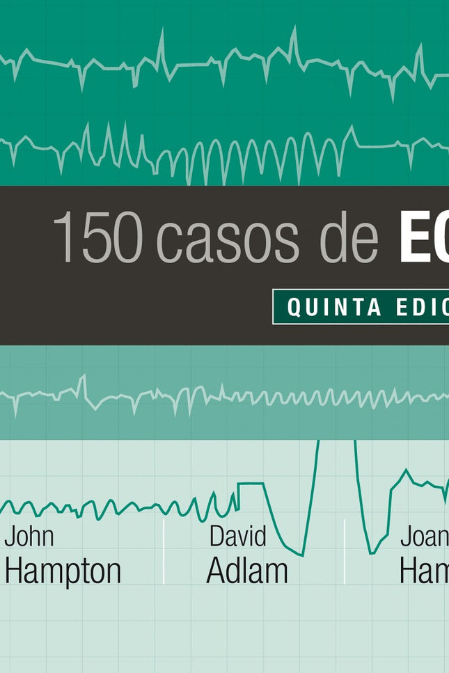 Libro 150 Casos De Ecg: 150 casos de ECG es la quinta edición de 150 problemas de ECG;en esta edición se ha modificado el título para destacar la importancia de relacionar el ECG con el paciente al que se le ha realizado dicha prueba, procediendo todos los registros de pacientes reales. Este manual sigue manteniendo el objetivo de las ediciones previas: mejorar los conocimientos del lector acerca del ECG poniendo a prueba sus habilidades de reconocimiento.