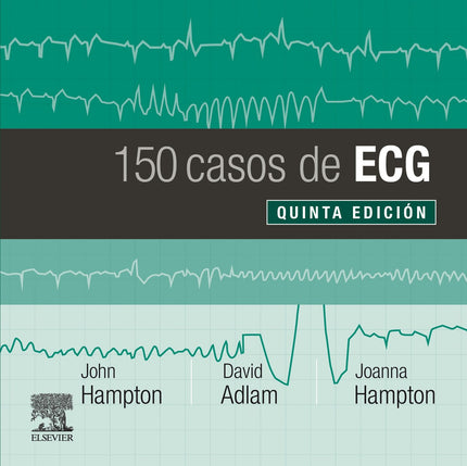 Libro 150 Casos De Ecg: 150 casos de ECG es la quinta edición de 150 problemas de ECG;en esta edición se ha modificado el título para destacar la importancia de relacionar el ECG con el paciente al que se le ha realizado dicha prueba, procediendo todos los registros de pacientes reales. Este manual sigue manteniendo el objetivo de las ediciones previas: mejorar los conocimientos del lector acerca del ECG poniendo a prueba sus habilidades de reconocimiento.