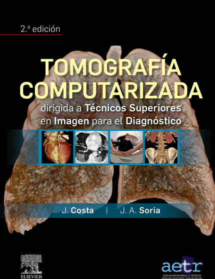 Collection image for: Técnicas de diagnóstico por la imagen